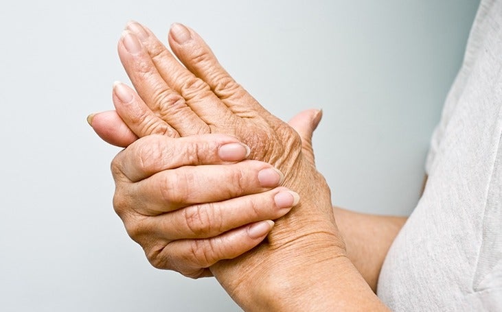 Senior woman holding her arthritic hands